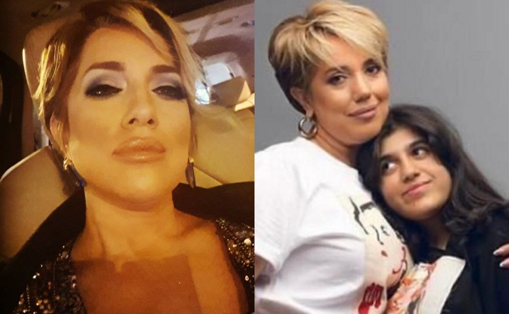 Lalə Məmmədova plastik əməliyyatdan sonra 1598722087 205624 nl83q7lanh.jpg