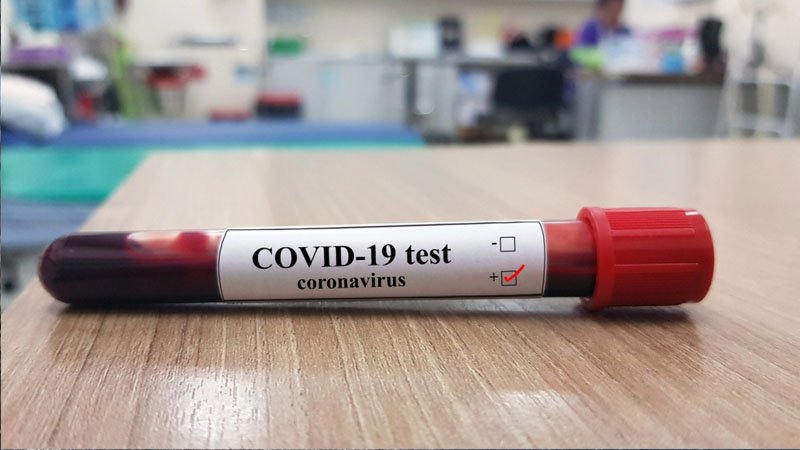 Koronavirus yoluxanların sayı azaldı 1629380306 1629380245 koronaanalizqaynar.jpg
