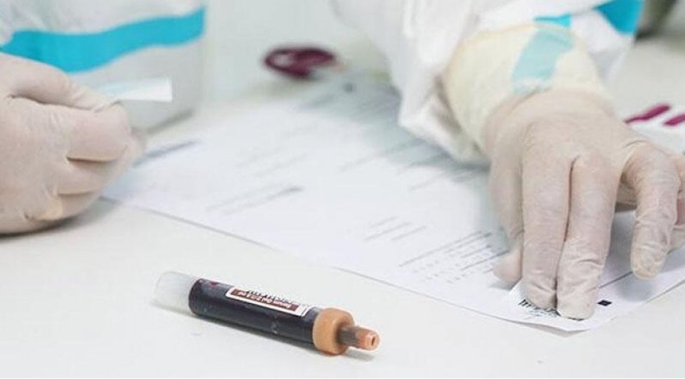 Aspirin kömək etməyəcək 1634265077 e20b21ae163423392919701680110145523.jpg