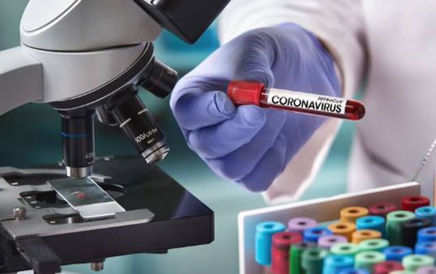 Yoluxanların bu günə olan statistikası 1648820456 koronavirus.jpg