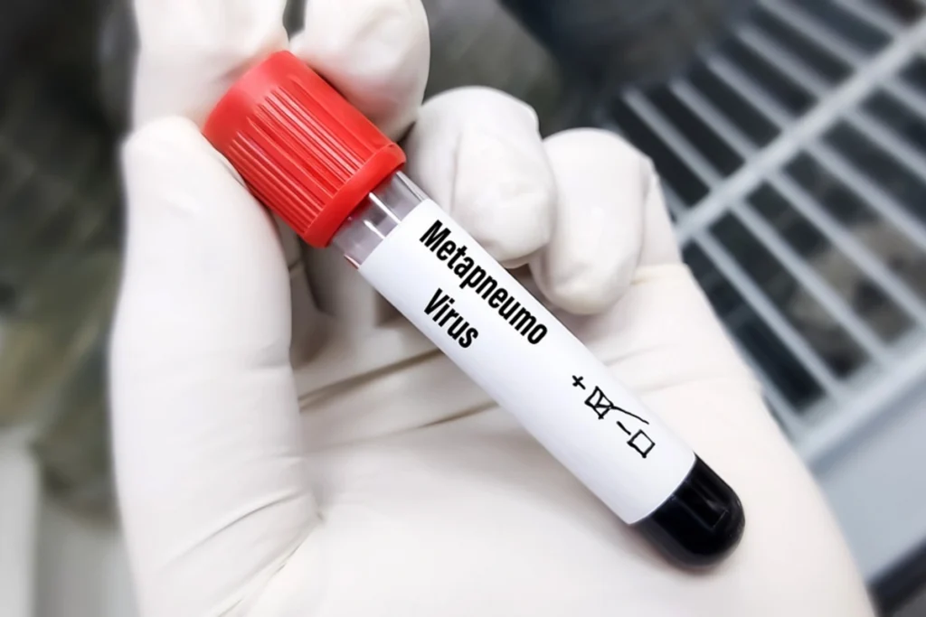 Yeni yayılan virus üçün risk qrupları müəyyən edildi Virus.webp
